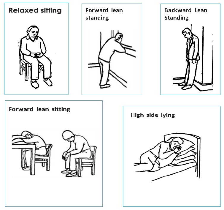 Long COVID Rehabilitation: A guide for patients and carers | First ...