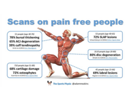 scans on pain free people illustration of a human body with facts and figures attached